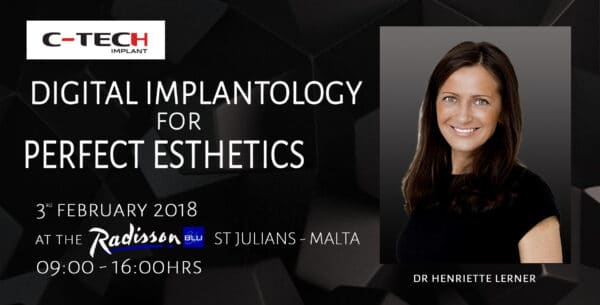 DIGITAL IMPLANTOLOGY FOR PERFECT ESTHETICS